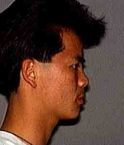 Case photo 1 for Lahn Van Le (MALE)