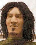 Case photo 1 for John  Doe (MALE)