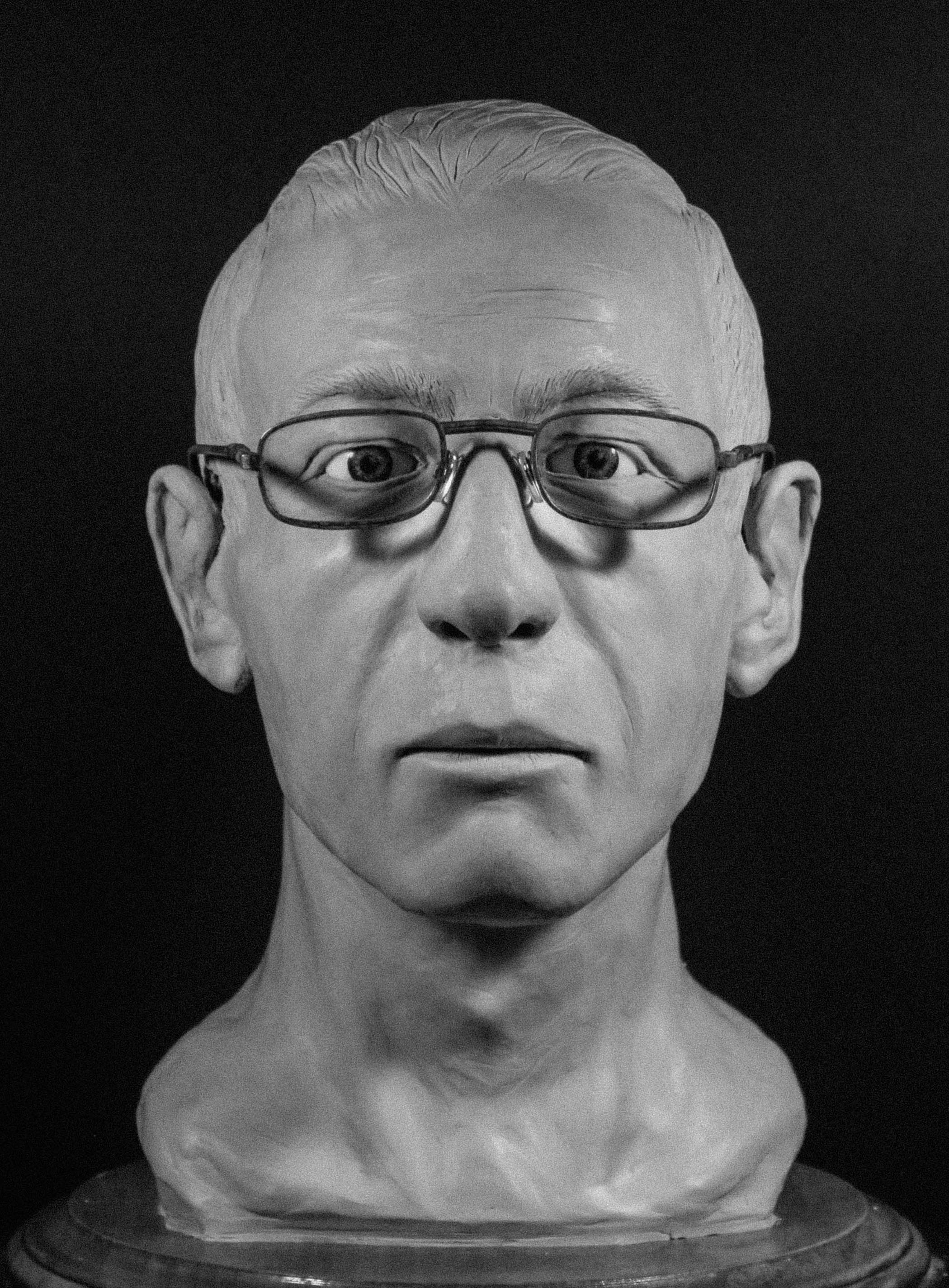 Case photo 1 for John  Doe (MALE)