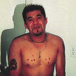 Case photo 1 for Alberto  Torres (MALE)