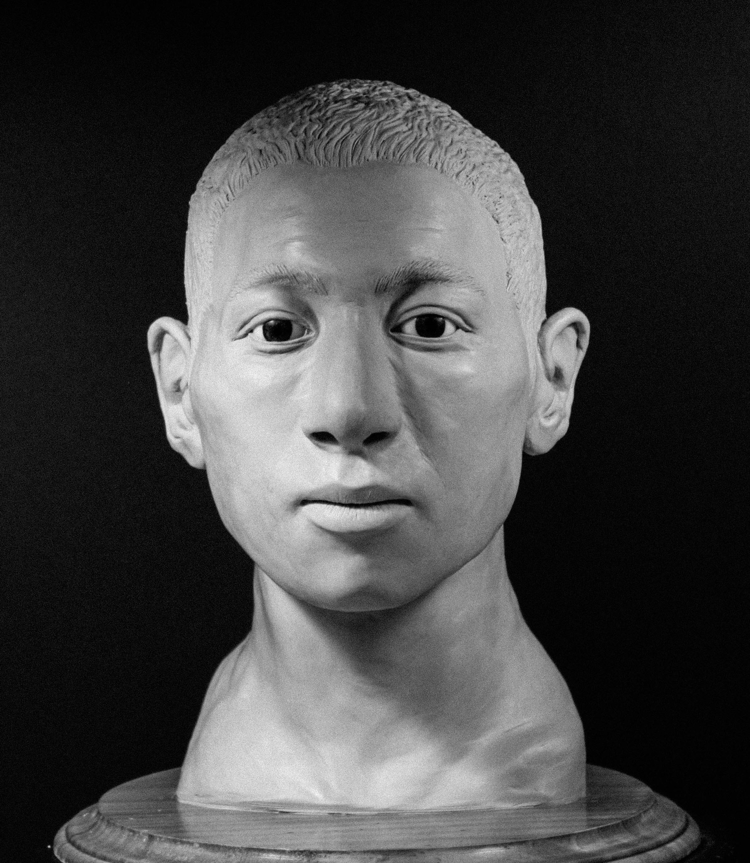 Case photo 1 for John  Doe (MALE)