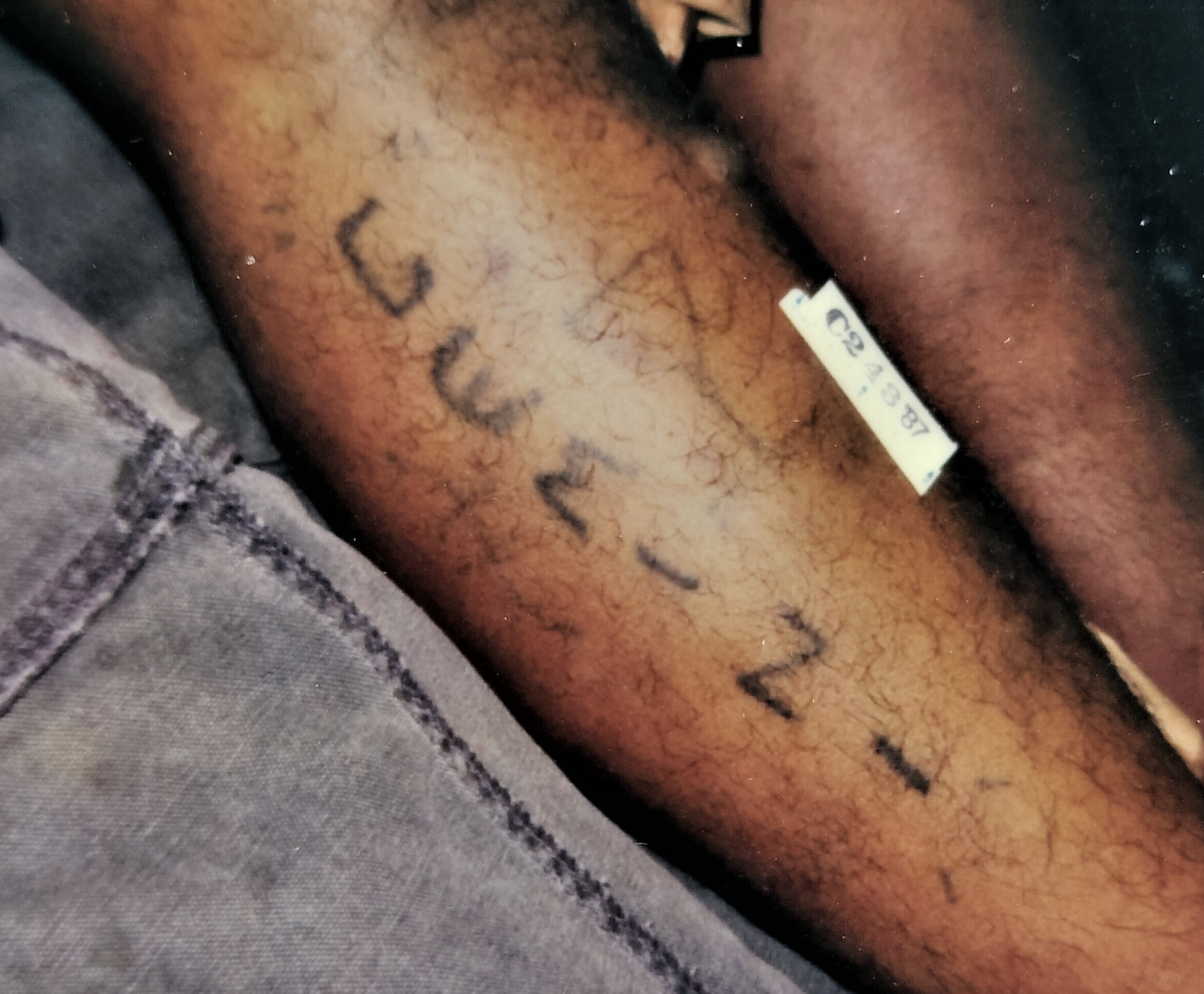 Case photo 1 for John  Doe (MALE)