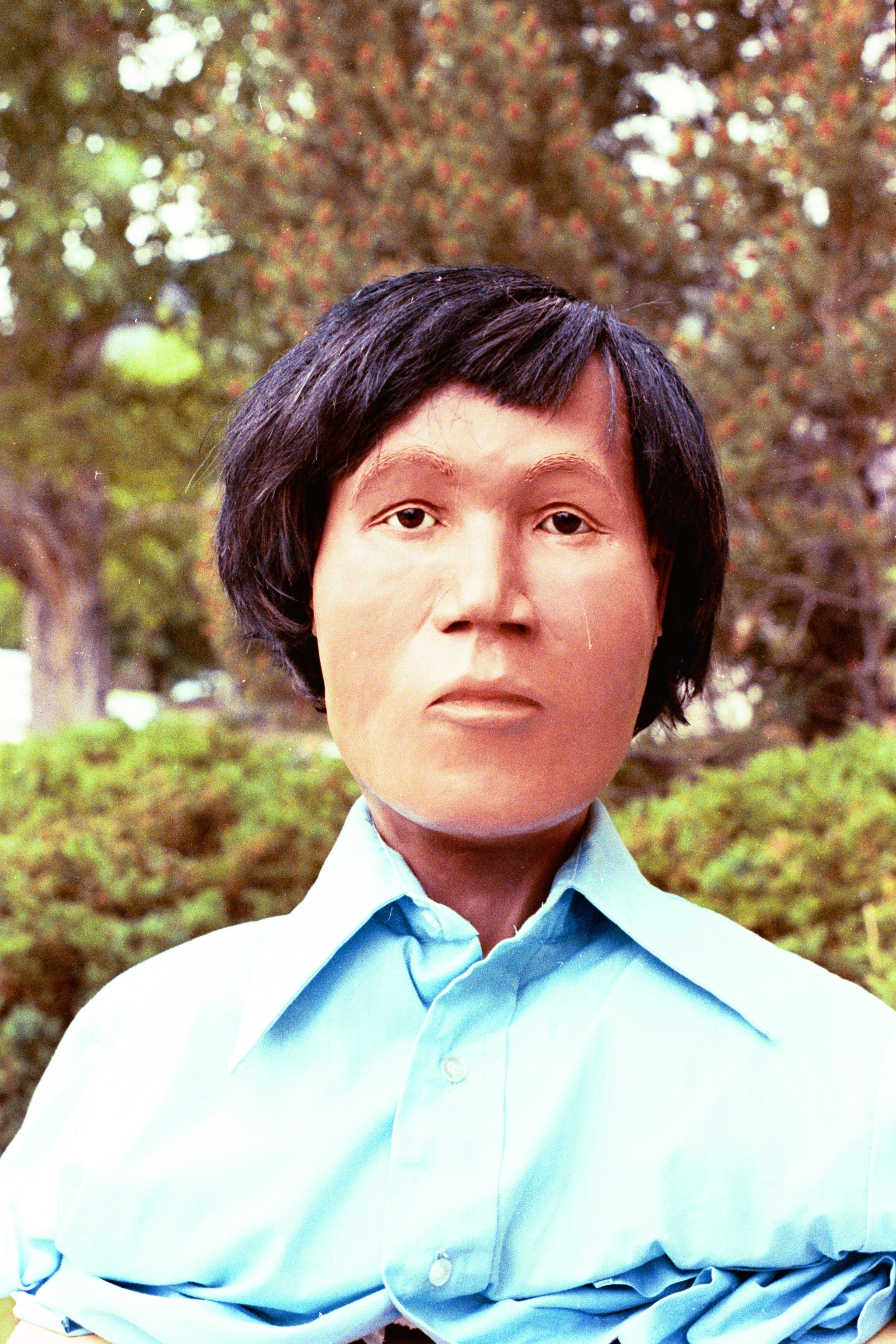 Case photo 2 for John  Doe (MALE)
