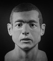 Case photo 1 for John  Doe (MALE)