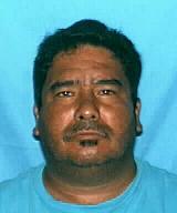 Case photo 1 for Javier  Perez-Sotelo (MALE)